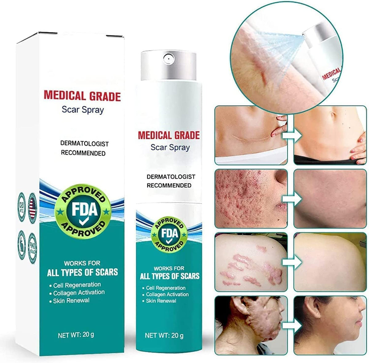 Spray Anti-cicatrices South Moon Médical Grade Scar