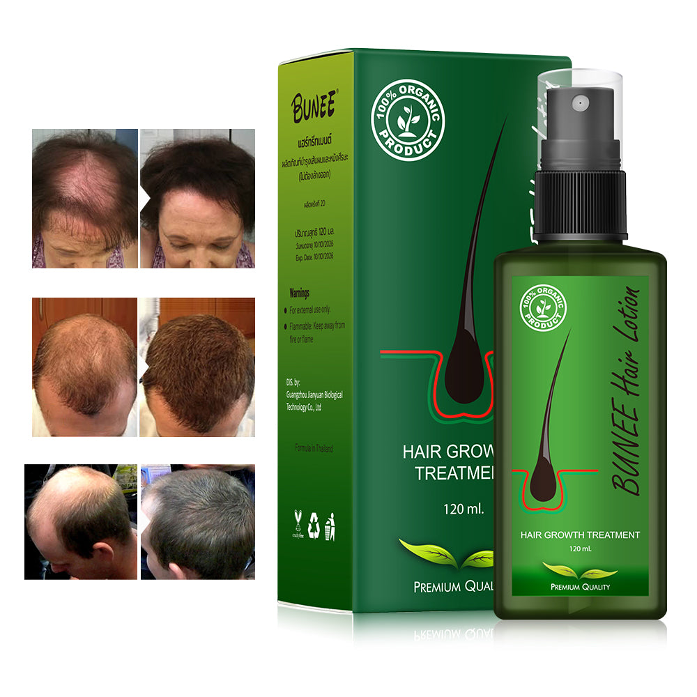 HAIR TREATMENT 30ml
