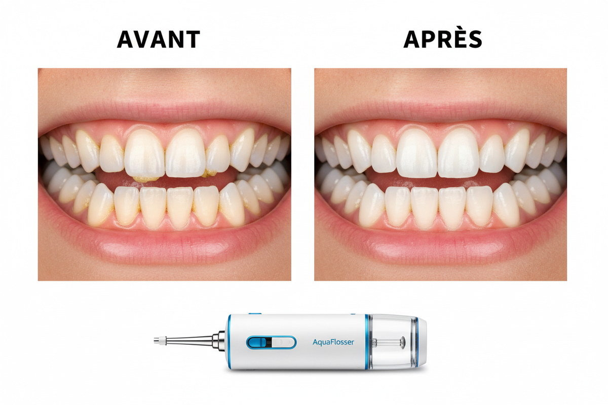 AquaFlosser Avant Après