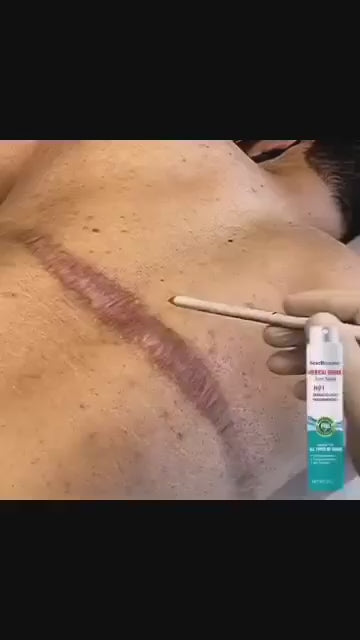 Spray Anti-cicatrices South Moon Médical Grade Scar