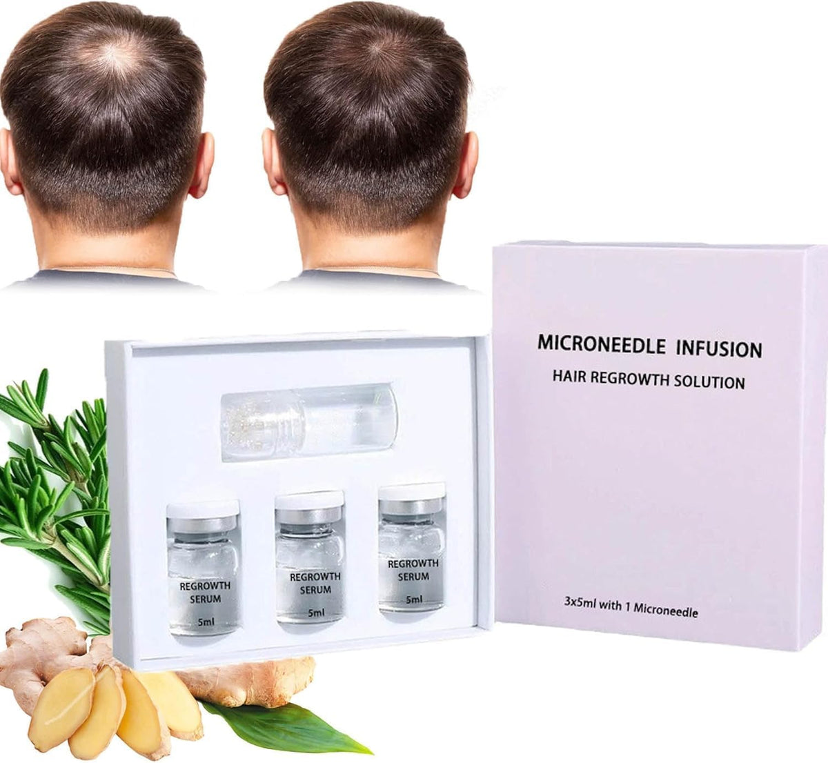 Microneedle Infusion – Sérum Repousse Cheveux